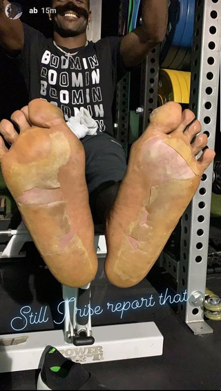 Illustration for article titled Antonio Brown's Feet Are A Nightmare